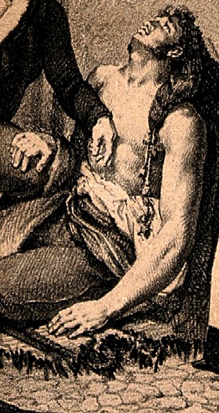 Man Weak From Yellow Fever